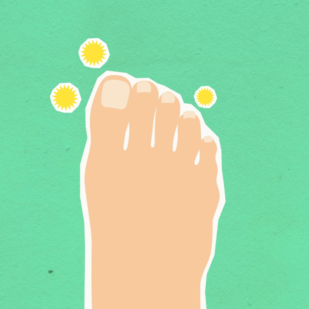 Fungal Nail Treatment in Derbyshire